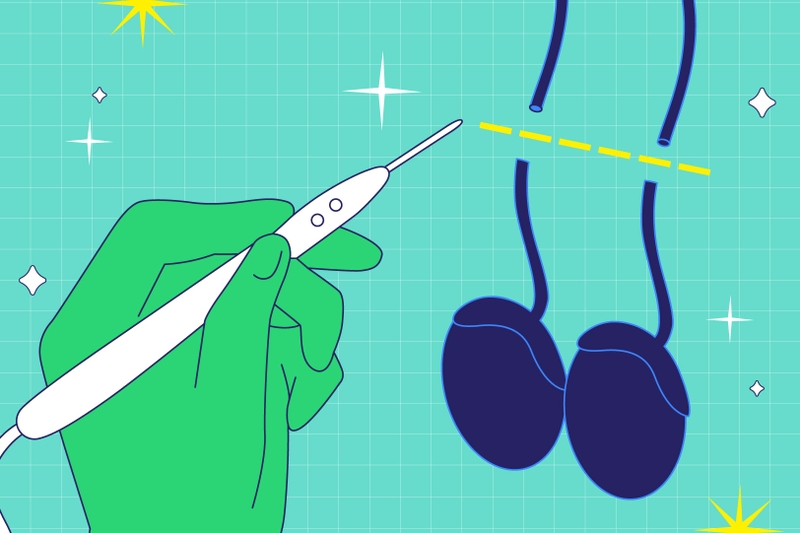 Vasectomy FAQs